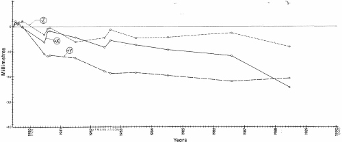 Line graph